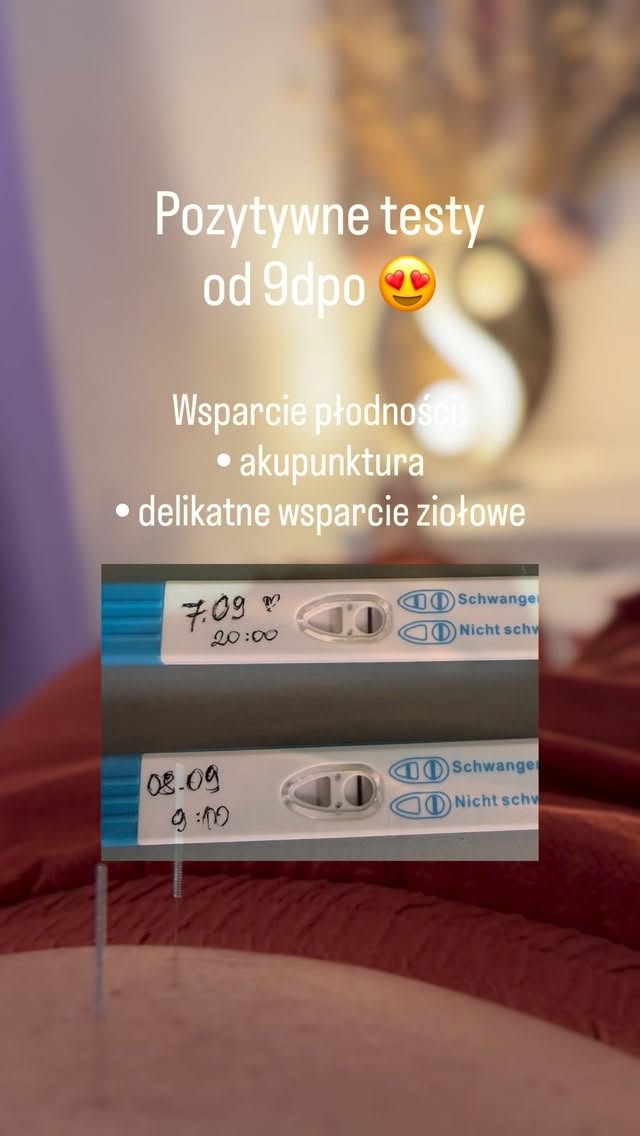 🤍 9 dpo i dwie kreski.
Po wcześniejszej stracie i miesiącach napięcia, lęku i gonitwy myśli - pojawiła się dobra wiadomość.
W tej historii ważne było nie tylko wsparcie cyklu i owulacji, ale też wyciszenie, poczucie bezpieczeństwa i zaopiekowanie emocjami.
🌸 Dziś jest radość, ale też świadomość, że to dopiero początek tej drogi.
Trzymamy kciuki za kolejne spokojne tygodnie. 🤍
Jeśli jesteś w trakcie starań naturalnych, przygotowań do procedury ivf lub transferu, zapraszam do mnie. 🌸
Zaopiekuj się sobą w Bertha Holistic.
#akupunkturapłodności #wsparciepłodności