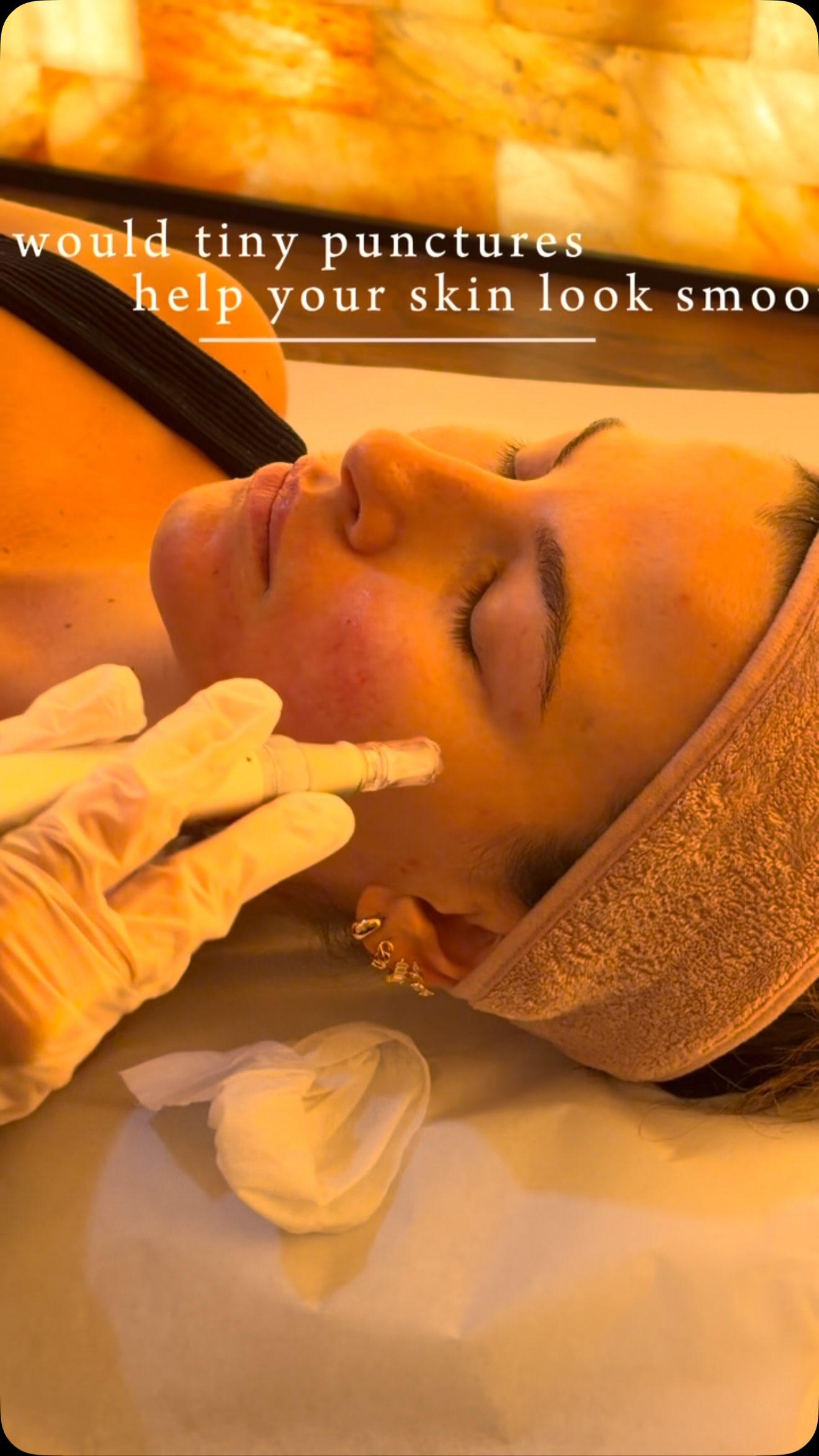 Tiny needles, a science-backed approach to skin renewal. ✨
Microneedling creates controlled microchannels in the skin, triggering its natural repair response and encouraging collagen and elastin production. Over time, this can help improve skin texture and soften the appearance of fine lines and acne scars.
Curious about trying it? Your first microneedling facial at Shifa is $250—regularly $300—until October 31!
🕐 Session length: 1 hour
📍 Shifa Full Spectrum Health Solutions | Uxbridge
🌿 Book at shifahealing.ca or through the link in our bio.
#Microneedling #UxbridgeOntario #ShifaWellness #Collagen #SkinRejuvenation